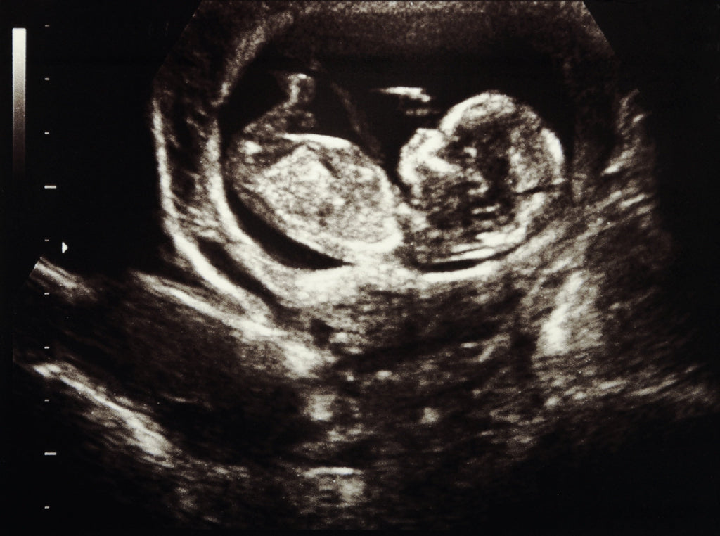 Dankzij echografie is het mogelijk om tijdens de zwangerschap te zien hoe je baby groeit en wanneer je bent uitgerekend. Of echo’s schadelijk zijn?